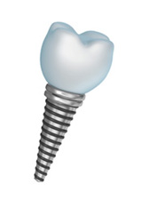 Dental implant screw